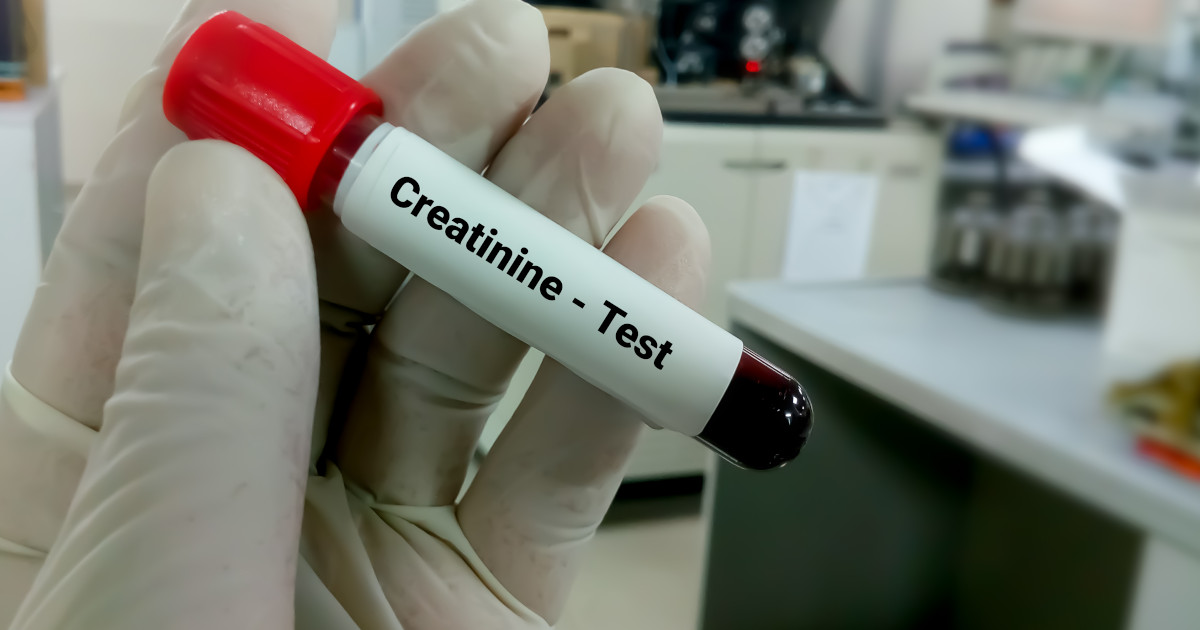 What Is a Creatinine Test?